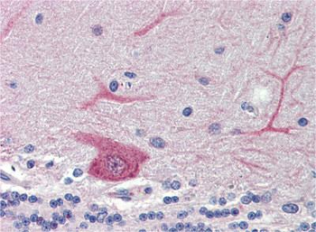 GABARAPL1 Rabbit Polyclonal Antibody