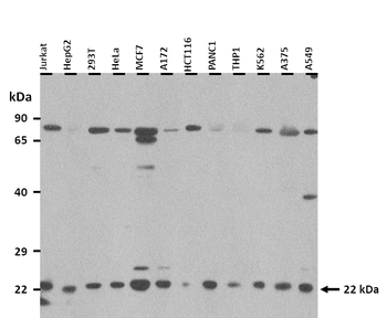 KRAS Rabbit Polyclonal Antibody