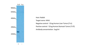 KRAS Rabbit Polyclonal Antibody