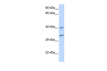 ALKBH3 Rabbit Polyclonal Antibody