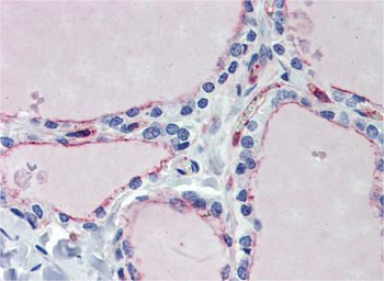 EHD4 Rabbit Polyclonal Antibody