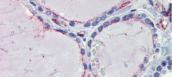 EHD4 Rabbit Polyclonal Antibody