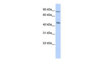 C6orf199 Rabbit Polyclonal Antibody