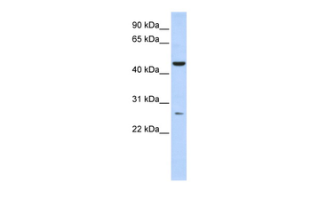 C6orf199 Rabbit Polyclonal Antibody