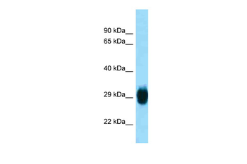 Ska1 Rabbit Polyclonal Antibody