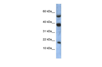 ATXN7L1 Rabbit Polyclonal Antibody