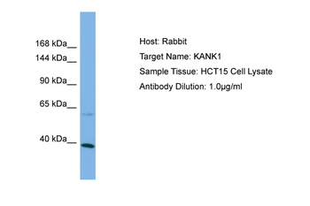 KANK1 Rabbit Polyclonal Antibody