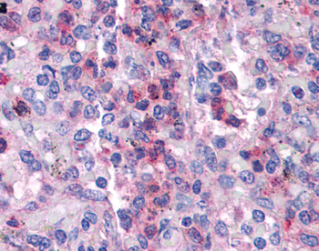 SGK3 Rabbit Polyclonal Antibody