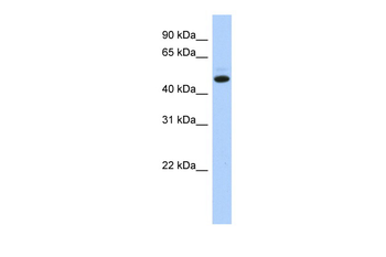 C5orf36 Rabbit Polyclonal Antibody