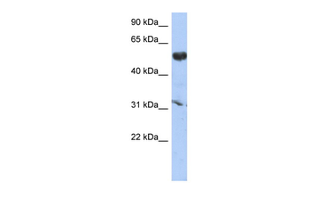 CYP4X1 Rabbit Polyclonal Antibody