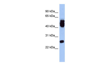 ERAS Rabbit Polyclonal Antibody