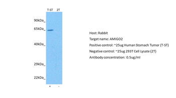 AMIGO2 Rabbit Polyclonal Antibody