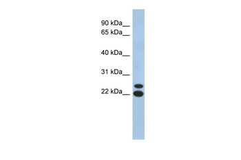 C19orf54 Rabbit Polyclonal Antibody