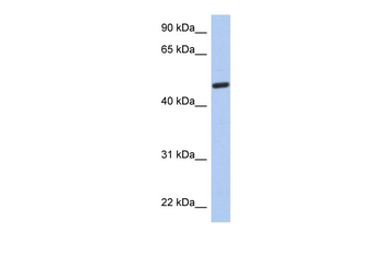 CATIP Rabbit Polyclonal Antibody