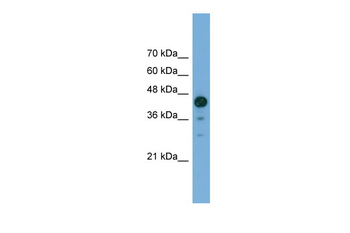 CATIP Rabbit Polyclonal Antibody
