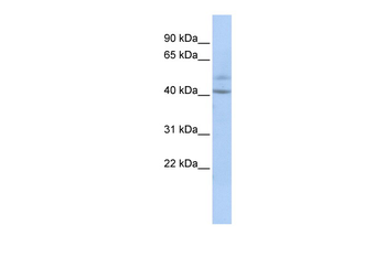 SPATC1 Rabbit Polyclonal Antibody