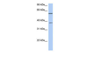 NUP43 Rabbit Polyclonal Antibody
