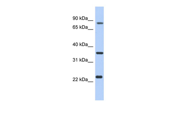C17orf82 Rabbit Polyclonal Antibody