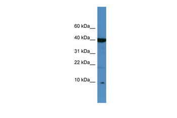 SPINK6 Rabbit Polyclonal Antibody