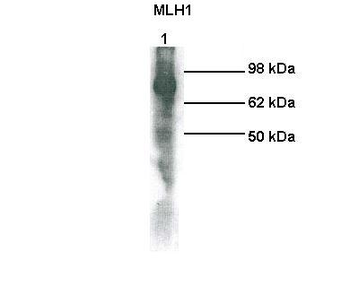 MLH1 Rabbit Polyclonal Antibody