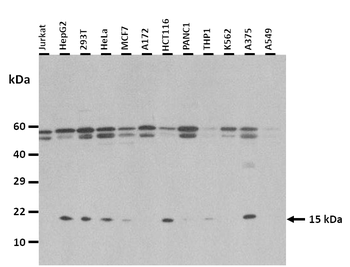 NDP Rabbit Polyclonal Antibody