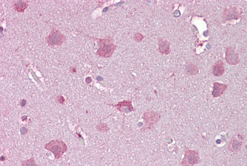 NDP Rabbit Polyclonal Antibody