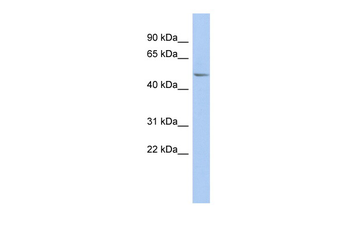 PPOX Rabbit Polyclonal Antibody