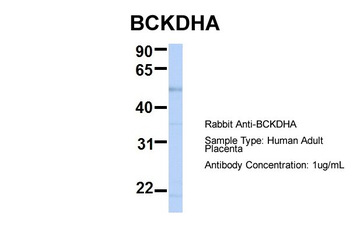 BCKDHA Rabbit Polyclonal Antibody
