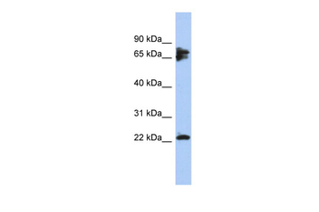 PPP3R1 Rabbit Polyclonal Antibody