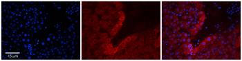RPL18 Rabbit Polyclonal Antibody