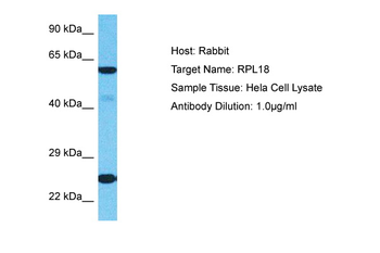 RPL18 Rabbit Polyclonal Antibody