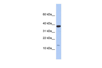 RPL27 Rabbit Polyclonal Antibody