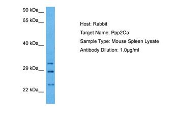 PPP2CA Rabbit Polyclonal Antibody