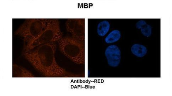 MBP Rabbit Polyclonal Antibody