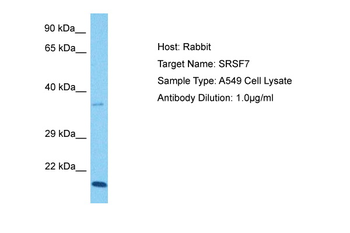 SFRS7 Rabbit Polyclonal Antibody