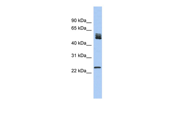 SFRS7 Rabbit Polyclonal Antibody