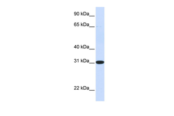 PBLD Rabbit Polyclonal Antibody