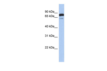 MTMR12 Rabbit Polyclonal Antibody