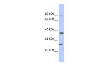 MYD88 Rabbit Polyclonal Antibody