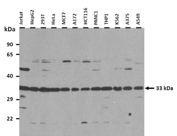 MYD88 Rabbit Polyclonal Antibody