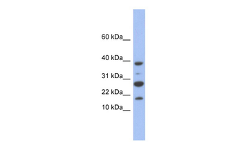 NDUFC1 Rabbit Polyclonal Antibody