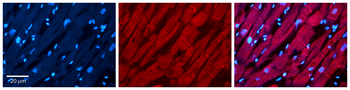 POLB Rabbit Polyclonal Antibody