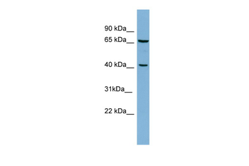POLB Rabbit Polyclonal Antibody