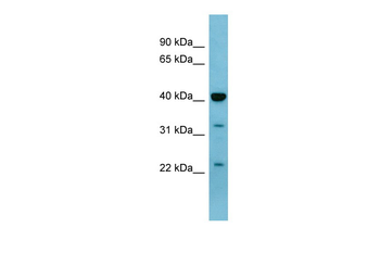 MAPK3 Rabbit Polyclonal Antibody