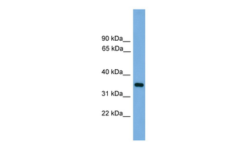 PRSS3 Rabbit Polyclonal Antibody