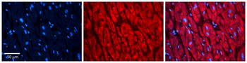 RAD23B Rabbit Polyclonal Antibody