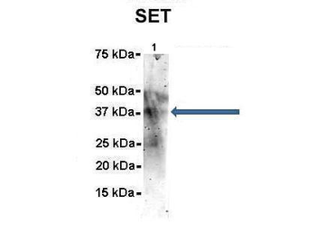 SET Rabbit Polyclonal Antibody