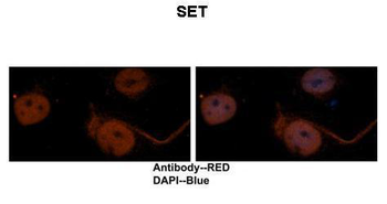 SET Rabbit Polyclonal Antibody