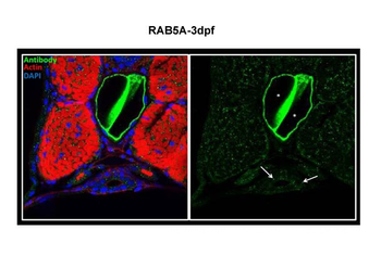 RAB5A Rabbit Polyclonal Antibody