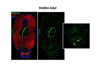 RAB5A Rabbit Polyclonal Antibody